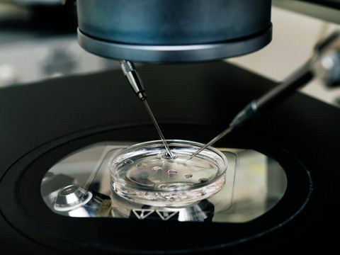 Unter einem Mikroskop ist eine Petrischale zu sehen. Mit Hilfe von Mikroinjektionsnadeln werden Eizelle und Spermium zusammengebracht