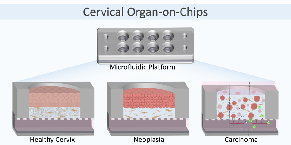 Image of Cervical organ-on-chips